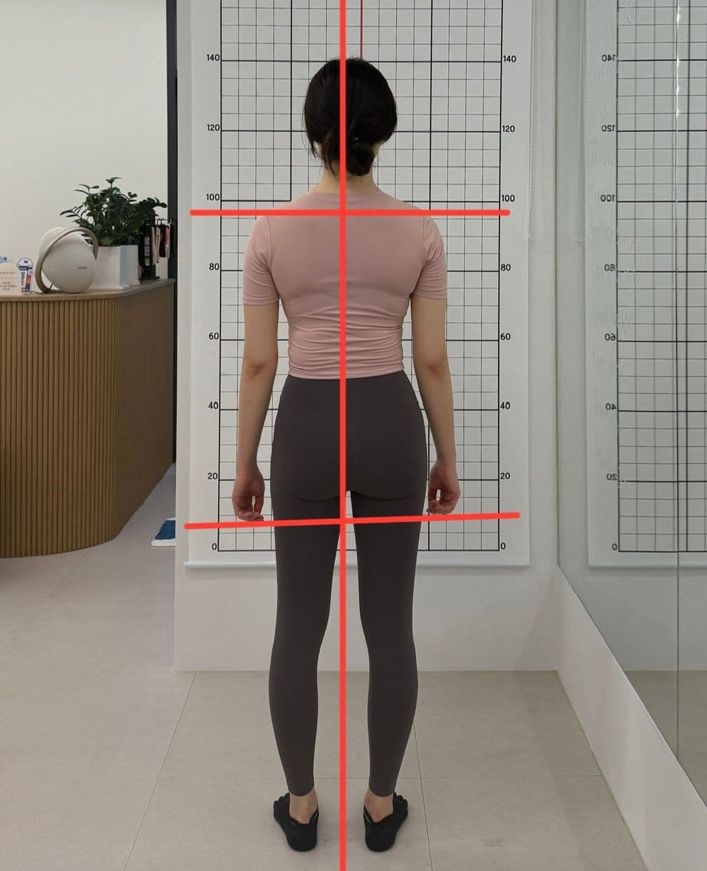 채도필라테스_30대여성_어깨_비포