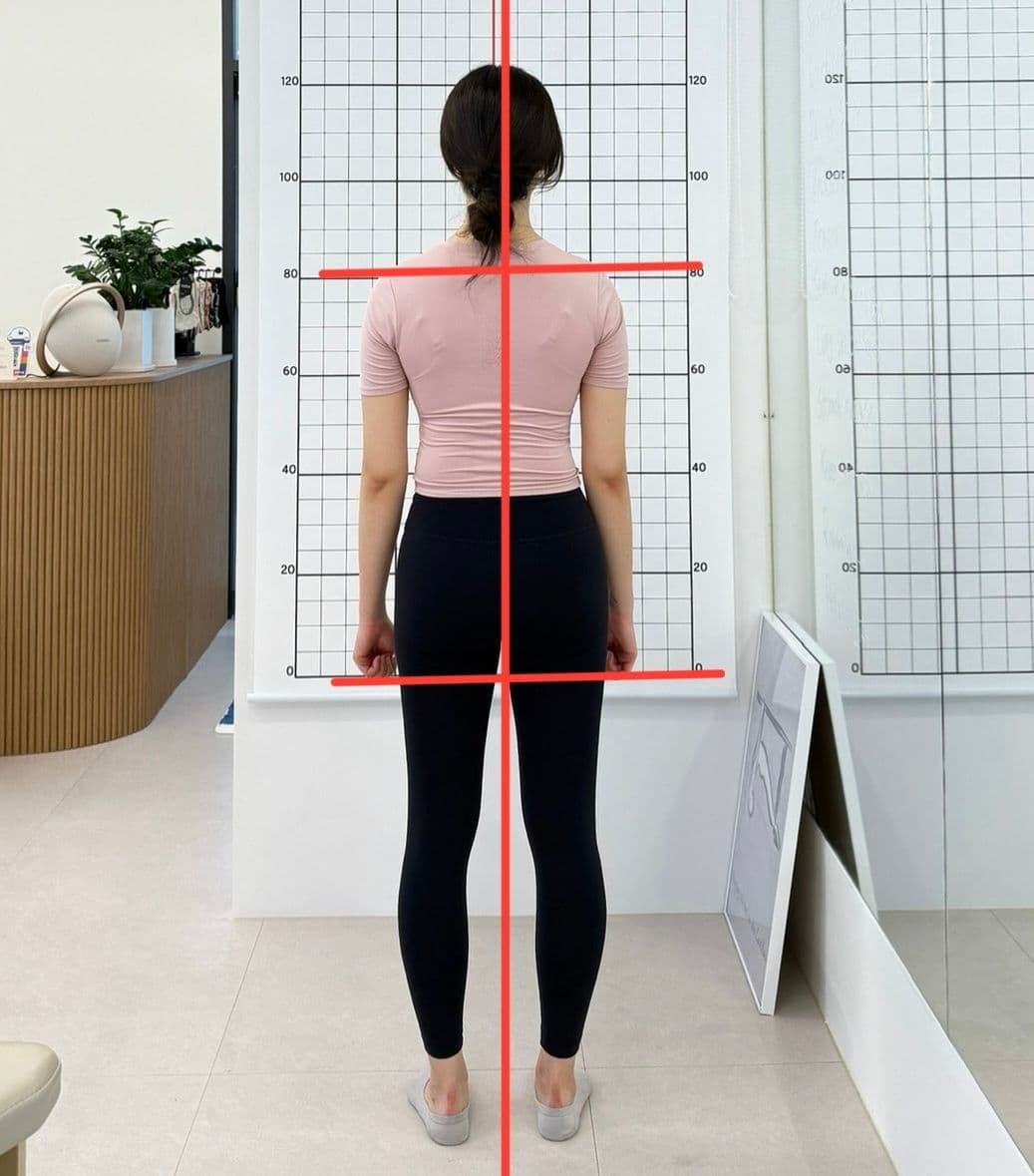 채도필라테스_30대여성_어깨_애프터